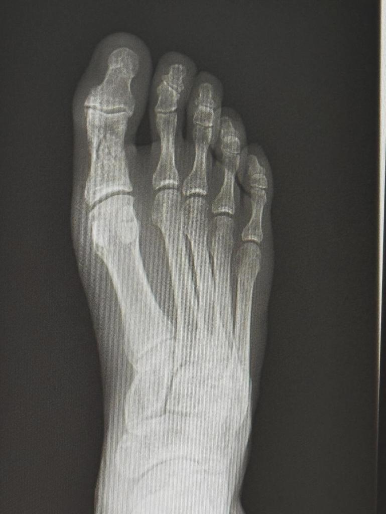 Ikram Aliskerov forfait pour l’UFC 318 après s’être fracturé le pied à l’approche du combat Ikram Aliskerov forfait pour l’UFC 318 après s’être fracturé le pied à l’approche du combat