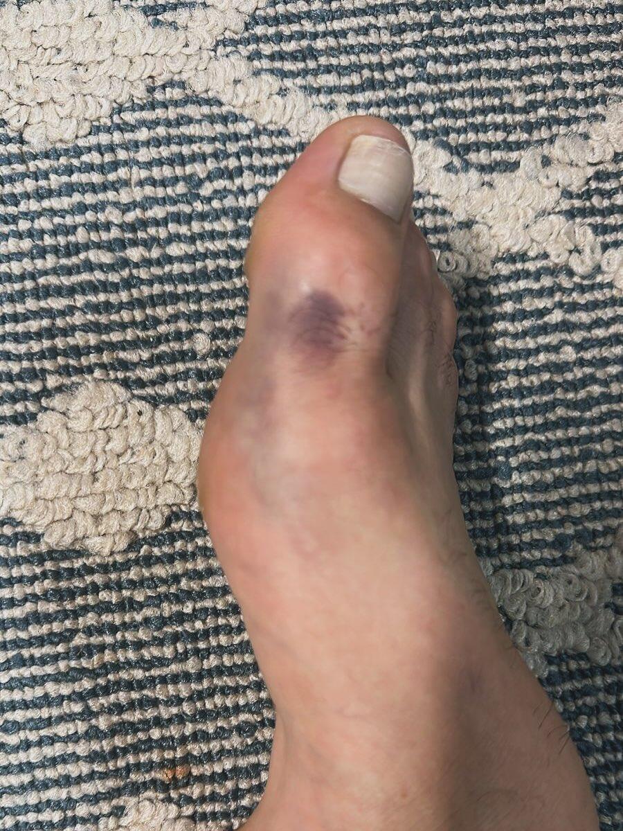 Ikram Aliskerov forfait pour l’UFC 318 après s’être fracturé le pied à l’approche du combat Ikram Aliskerov forfait pour l’UFC 318 après s’être fracturé le pied à l’approche du combat