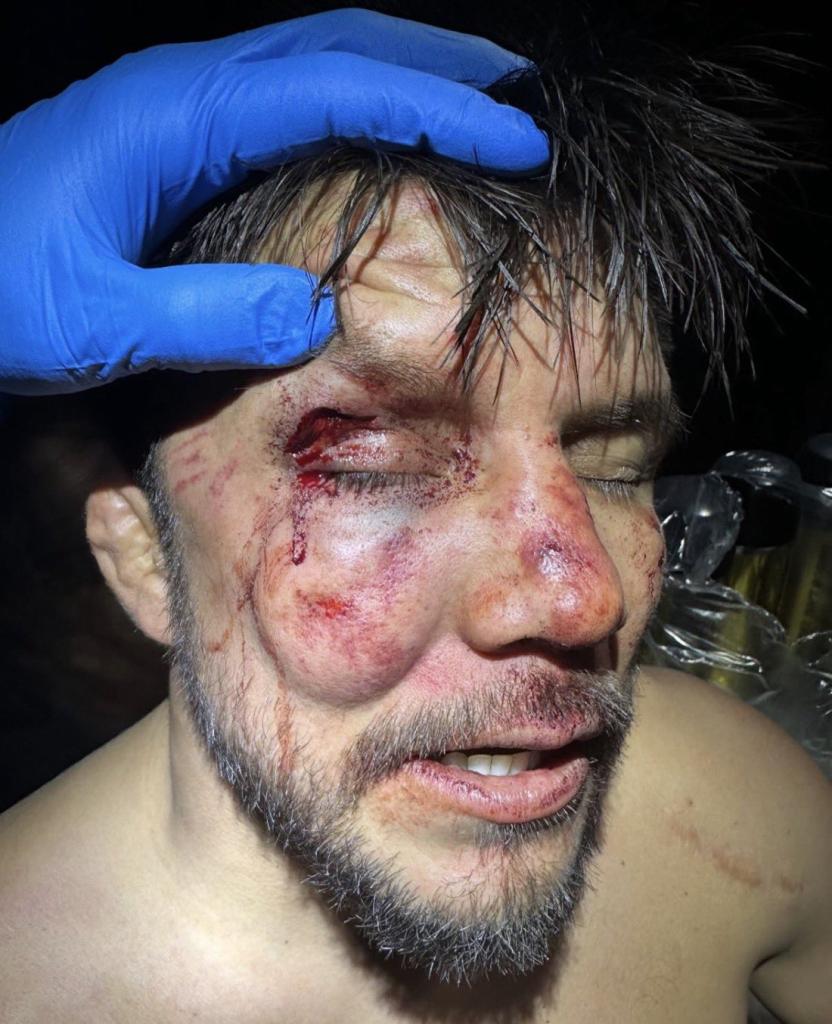 Henry Cejudo rend hommage à Payton Talbott et confirme sa retraite définitive du sport | UFC 323 Henry Cejudo rend hommage à Payton Talbott et confirme sa retraite définitive du sport | UFC 323