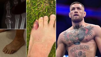 Conor McGregor révèle une fracture de l'orteil qui l'a contraint à se retirer de l'UFC 303