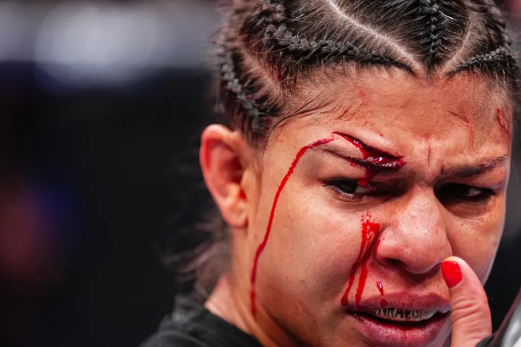 Mayra Bueno Silva publie une image de sa blessure | UFC 303