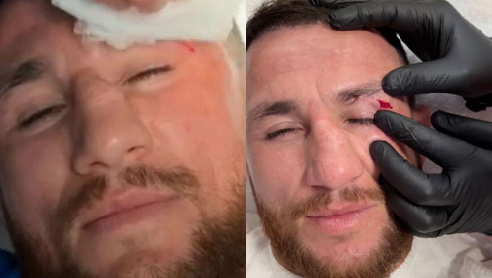 Dana White furieux contre Merab Dvalishvili pour avoir posté sa blessure | UFC 306