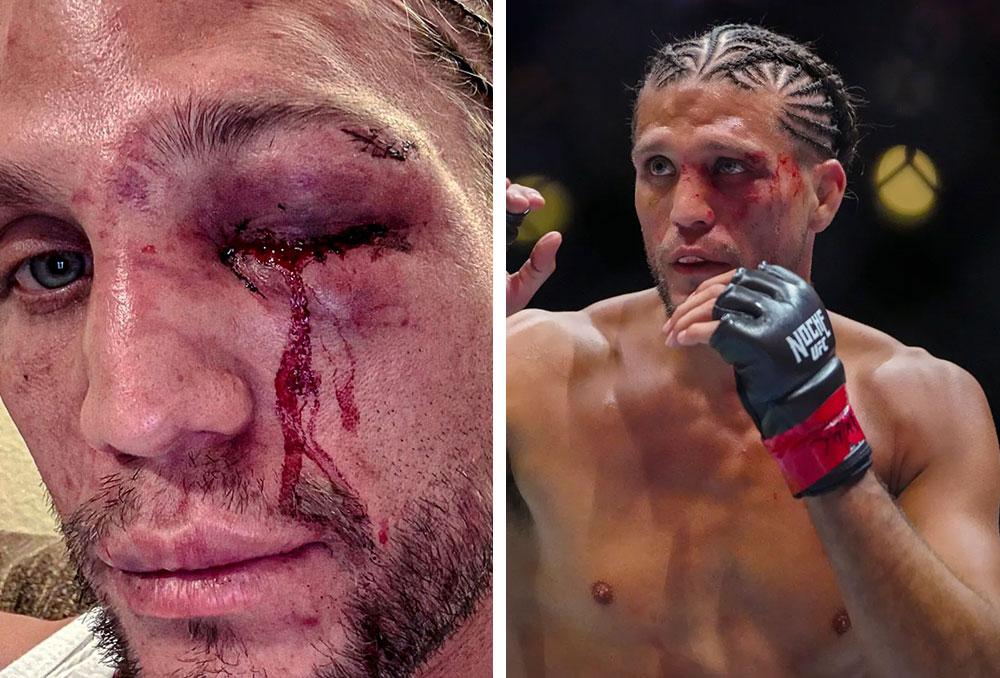 Brian Ortega réfléchit à son avenir après sa défaite à l'UFC 306