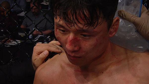UFC 206 - Les suspensions médicales